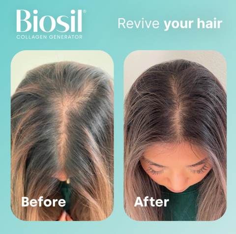 Biosil mini liquid capsules